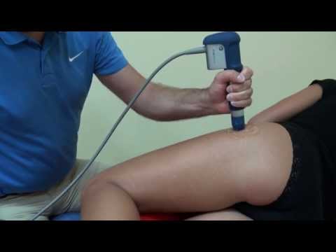 Terapia falą uderzeniową - Zapalenie kaletki krętarzowej