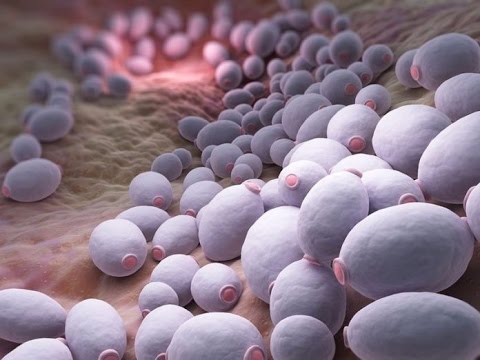 Веснушки текст песни проходила весна по опушке Темные пятна кожи фото