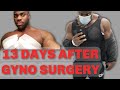Day 13 - Post Gynecomastia Surgery Update + what's the cost?