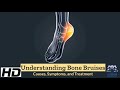 When Bones Get Battered: Exploring Bone Bruises and Their Remedies
