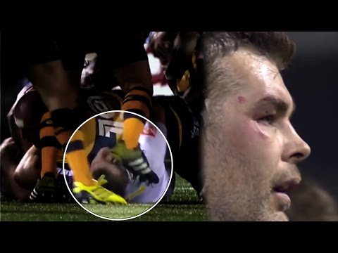 Matthew Rees stud almost takes out Nick Easter's eye