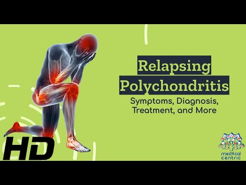 Frozen Shoulder Causes Signs and Symptoms Diagnosis and Treatment