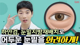 어두운 눈밑을 뽀용하게 인상체인지! #아이루미성형외과 #하안검