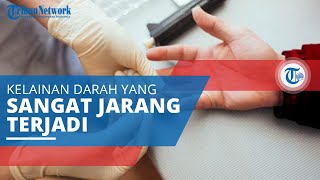 Paroxysmal Nocturnal Hemoglobinuria, Kelainan Kronis Ditandai dengan Terjadinya Perdarahan di Kulit