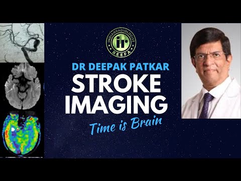 TIME IS BRAIN SERIES | STROKE IMAGING PART I | DR DEEPAK PATKAR |  BRAIN INFARCT
