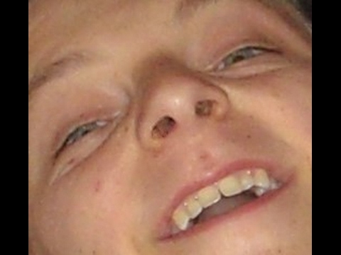 Steam Community :: Video :: LIVE