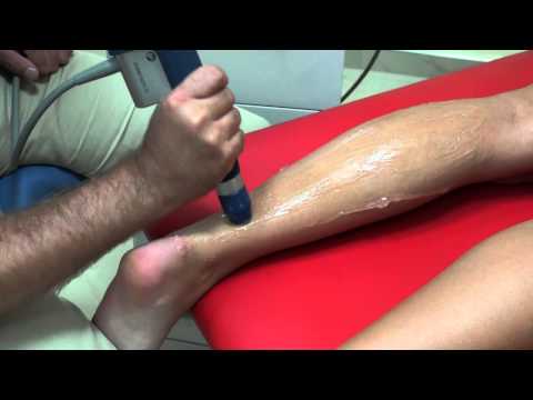 Terapia falą uderzeniową - Zapalenie ścięgna achillesa