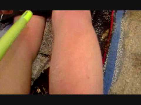 alkpote sisisi barcares