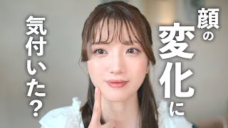 長年悩んだコンプレックスを美容整形で解消してきました。