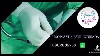 Rinoplastia Estructurada