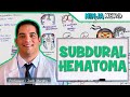 Subdural Hematoma Anatomy Etiology Pathophysiology Clinical Features Treatment