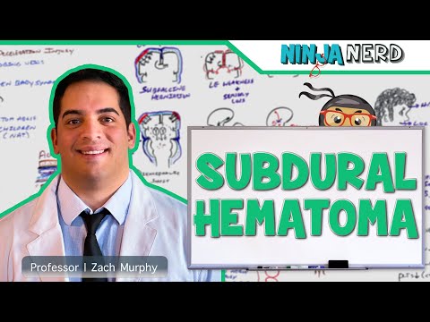 Stroke Syndromes MCA ACA ICA PCA Vertebrobasilar Artery Strokes Pathophysiology