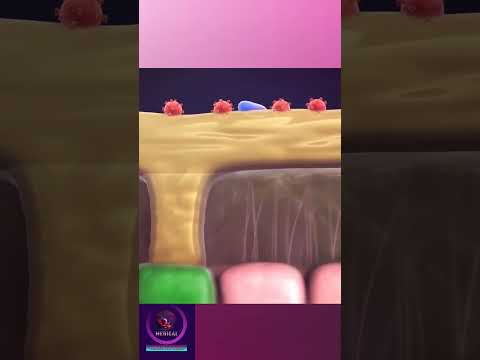 Nasal Rhinitis in cold situation #shorts