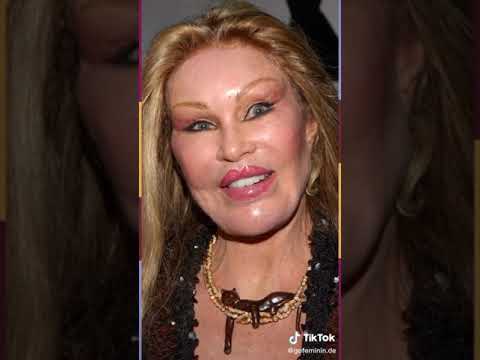 Diese Stars legten sich unter's Messer #shorts