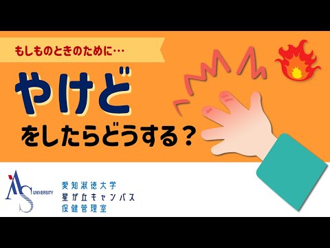 交流文化学科 やけどしたらどうする？