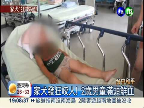 家犬發狂咬人! 男童頭部撕裂傷