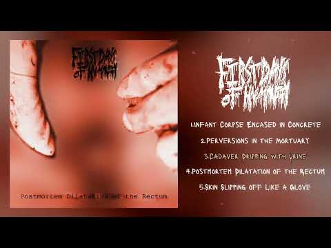 First Days Of Humanity - Postmortem dilatation of the rectum FULL (2023 Gorenoise)