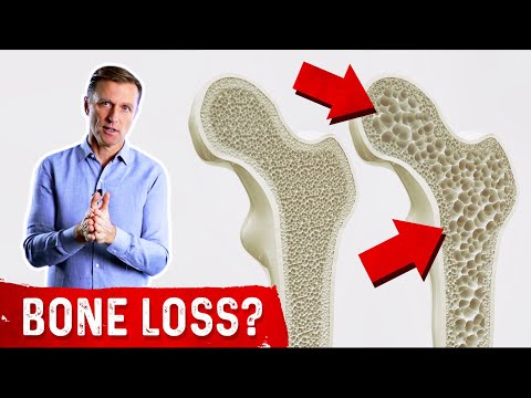 Does Keto Cause Bone Loss