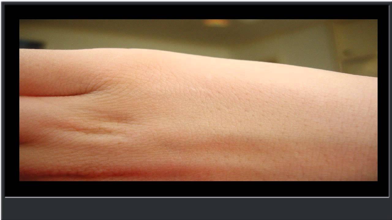 File:Light skin and hair.jpg - Wikimedia Commons