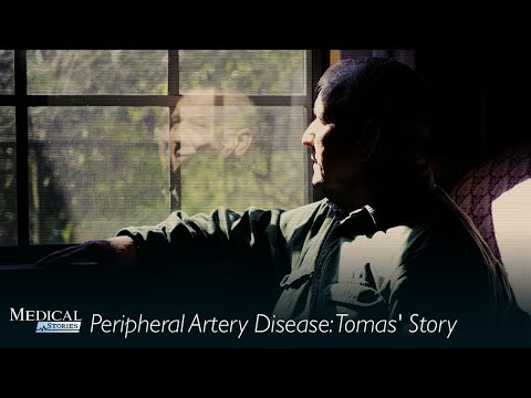 Medical Stories - Peripheral Arterial Disease (PAD) Tomas's Story