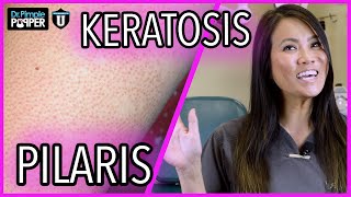 What Are These Bumps On My Skin? | Keratosis Pilaris | with Dr. Sandra Lee