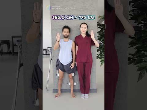 9.5 cm Taller! Leg Lengthening Surgery Before & After