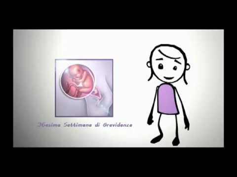 Fianchi fortemente irritati e vita Danza terapia per le articolazioni delle mani Video