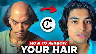 Loosing hairs = 50x worse life || How To Stop Hair fall in men || How to fix male pattern baldness