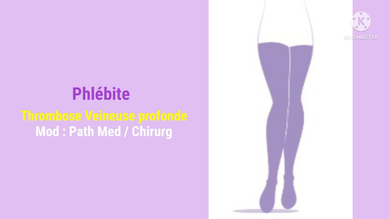 TVP, thrombose veineuse profonde ou phlébite.