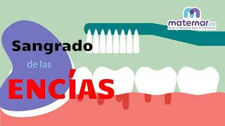 Sangrado de las encías en el embarazo | Maternar.co