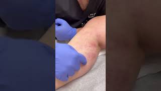 NJ Vein Specialists