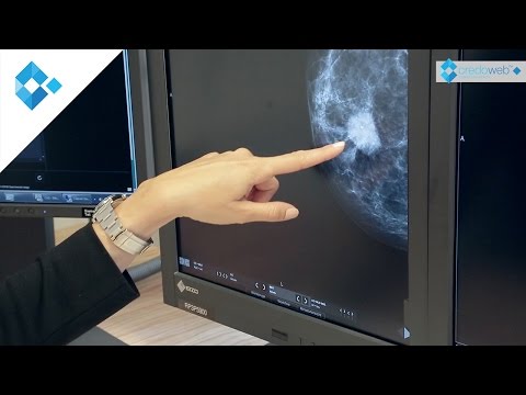 Gardasil impfung bei jungen Hpv warzen bekampfen. Papillom haut entfernen