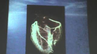 28) Dr. Essam Ezat 14-12-2015 [Coronary Heart Diseases-Myocardial infarction-Heart failure&Tumors ]