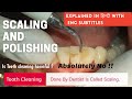 How Scaling Is Done Teeth Cleaning Scaling And Polishing