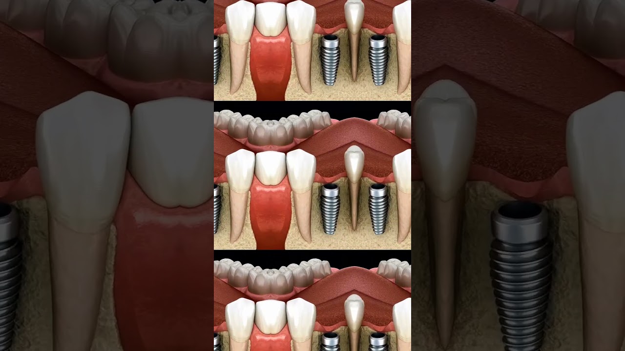 Lorena Reyes Nava-23