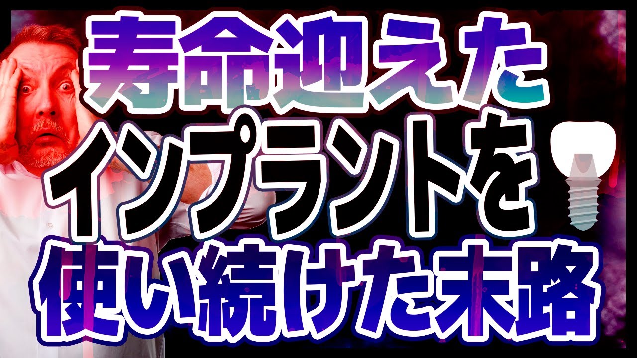 寿命が来たインプラントを使い続けるとどうなる?