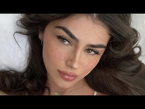 ღ you got rid of dark circles and eye bags! ~ lower blepharoplasty procedure 💉