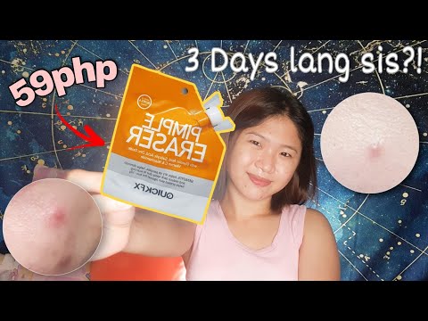 QUICKFX PIMPLE ERASER 3 DAYS REVIEW | EFFECTIVE BA? | Cess