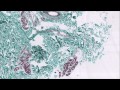 Ghostpoet - X Marks The Spot (Boxed In Remix ...