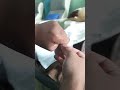 Pijat Refleksi Telah Hadir Di Ruko Terminal Pandaan Pasuruan 081232146882
