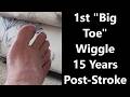 Big Toe Wiggle For The First Time 15 Years Post Stroke
