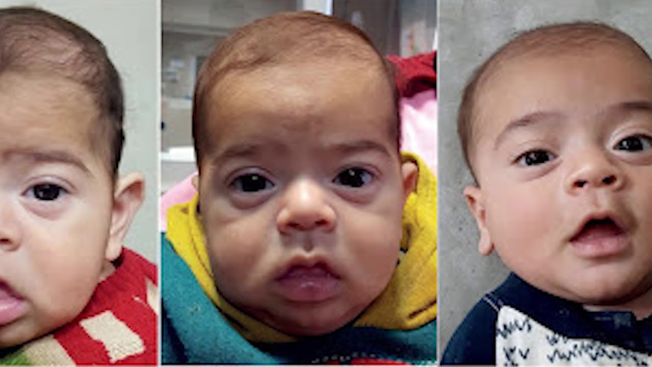 Bebeklerde Topuk Kanı İle Hastalıkların Teşhisi