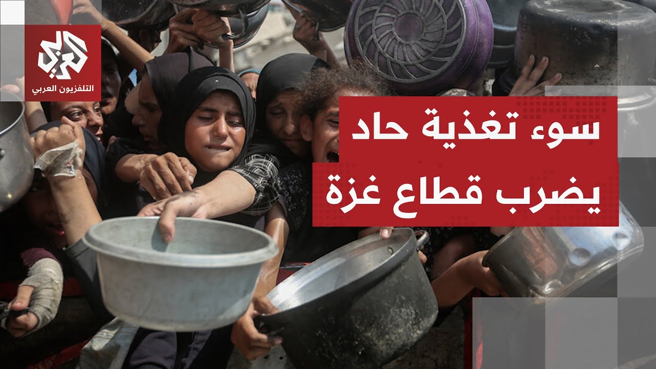 سوء تغذية حاد يضرب قطاع غزة مع استمرار الخروقات الإسرائيلية لاتفاق وقف إطلاق