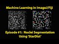 Machine Learning in ImageJ/Fiji - StarDist