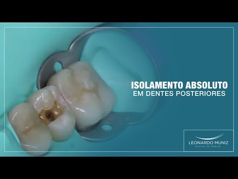Isolamento Absoluto em Dentes Posteriores | Leonardo Muniz