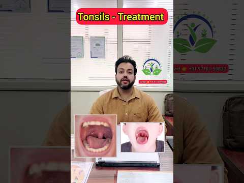 Tonsils - Treatment 😮 #shorts @DrShikhaSingh @dr.biswarooproychowdhury9958