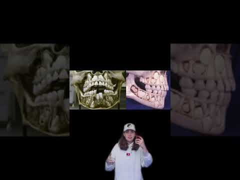 Human Body Design Flaws 🧍 w OnlyJayus - #Shorts