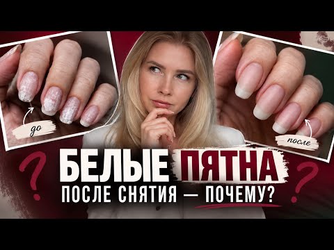 Обложка урока о белых пятнах после снятия