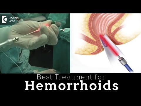 Laser Hemorrhoidoplasty vs Open Hemorrhoidectomy | Hemorrhoid Treatment - Dr. Rajasekhar M R