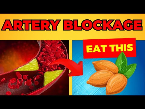 Top 10 Foods to Clean Your Arteries | Cardiovascular Health and Heart Disease Prevention!